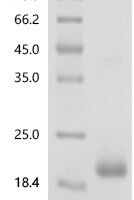 Human Ly6/PLAUR domain-containing protein 1 (LYPD1) Recombinant Protein, C-His, aa 21–117, E.coli - BioCrest Sci