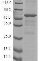 Human Cytokine-inducible SH2-containing protein (CISH) Recombinant Protein - BioCrest Sci