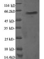 Human Large ribosomal subunit protein uL18 (RPL5) Recombinant Protein - BioCrest Sci