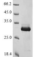 Human COMM domain-containing protein 5 (COMMD5) Recombinant Protein, N-His - BioCrest Sci