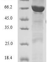 Human Twinfilin-2 (TWF2) Recombinant Protein - BioCrest Sci