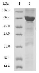 Human Twinfilin-2 (TWF2) Recombinant Protein, Homo sapiens (Human), E.coli, N-terminal GST-tagged, 66.4 kDa, purity >≥ 90% as determined by SDS-PAGE.