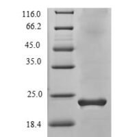 Human Vascular endothelial growth factor B (VEGFB) Recombinant Protein, N-His - BioCrest Sci