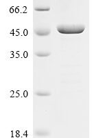 Human Neutral cholesterol ester hydrolase 1 (NCEH1), partial Recombinant Protein - BioCrest Sci