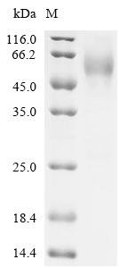 Human Muscle, skeletal receptor tyrosine-protein kinase (MUSK), partial Recombinant Protein, Homo sapiens (Human), Homo sapiens (Human), N-terminal 6xHis-tagged, 53.9 kDa, purity >≥ 95% as determined by SDS-PAGE.