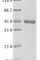 Human Protein VPRBP (VPRBP), partial Recombinant Protein - BioCrest Sci