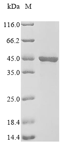 Human Protein VPRBP (VPRBP), partial Recombinant Protein, Homo sapiens (Human), E.coli, N-terminal 10xHis-tagged, 46.0 kDa, purity >≥ 90% as determined by SDS-PAGE.