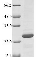 Escherichia coli Uncharacterized protein yjbL (yjbL) Recombinant Protein - BioCrest Sci