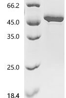 Human Interleukin-11 (IL11) Recombinant Protein, N-hFc1 - BioCrest Sci