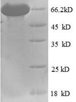Human Bile acid receptor (NR1H4) Recombinant Protein - BioCrest Sci