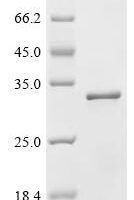 Human Chromobox protein homolog 1 (CBX1) Recombinant Protein - BioCrest Sci