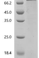 Human LIM domain-containing protein 1 (LIMD1) Recombinant Protein, C-His - BioCrest Sci
