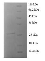 Human Protein S100-A1 (S100A1), partial Recombinant Protein - BioCrest Sci