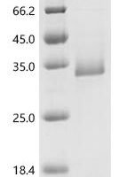 Human Protein-glutamine gamma-glutamyltransferase K (TGM1), partial Recombinant Protein, C-His, aa 579–787 - BioCrest Sci