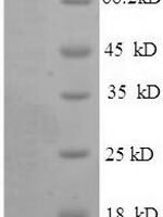 Human Bone morphogenetic protein 1 (BMP1) Recombinant Protein, N-His - BioCrest Sci