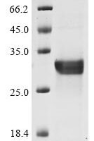 Human NACHT, LRR and PYD domains-containing protein 3 (NLRP3), partial Recombinant Protein, N-His, aa 29–231 - BioCrest Sci