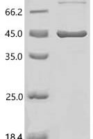 Human Keratocan (KERA) Recombinant Protein - BioCrest Sci