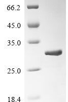 Saccharomyces cerevisiae Eukaryotic peptide chain release factor subunit 1 (SUP45), partial Recombinant Protein - BioCrest Sci