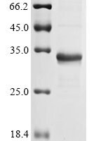 Dermatophagoides farinae Mite allergen Der f 3 (DERF3) Recombinant Protein - BioCrest Sci