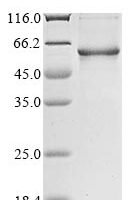 Human Vitronectin (VTN) Recombinant Protein, Tag-Free - BioCrest Sci