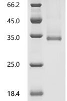 Rat Vascular endothelial growth factor D (Vegfd) Recombinant Protein, N-hFc1, aa 94–210, Purity ≥95% - BioCrest Sci