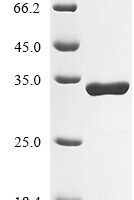 Rat Dystrophin (Dmd), partial Recombinant Protein - BioCrest Sci