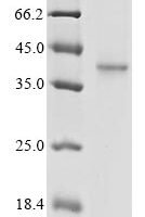 Human coronavirus OC43 Spike glycoprotein (S), partial Recombinant Protein, N-10His/C-Myc - BioCrest Sci