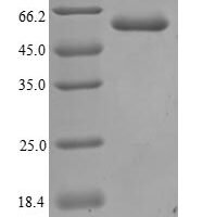 Human Angiopoietin-2 (ANGPT2), partial Recombinant Protein, N-His, aa 19–485, Yeast - BioCrest Sci