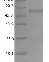 Human Mitochondrial import receptor subunit TOM34 (TOMM34) Recombinant Protein - BioCrest Sci