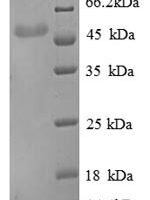 Human Beta-enolase (ENO3), partial Recombinant Protein - BioCrest Sci