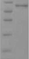 Human Small proline-rich protein 2B (SPRR2B) Recombinant Protein, N-His/C-Myc - BioCrest Sci