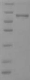 Human Small proline-rich protein 2B (SPRR2B) Recombinant Protein, N-His/C-Myc, Homo sapiens (Human), Yeast, N-terminal 6xHis-tagged and C-terminal Myc-tagged, 11.5 kDa, purity >≥ 90% as determined by SDS-PAGE.