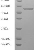 Human parvovirus B19 Minor capsid protein VP1, partial Recombinant Protein, N-His - BioCrest Sci