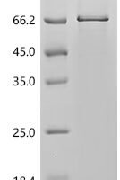 Human Myc proto-oncogene protein (MYC) Recombinant Protein, C-His - BioCrest Sci