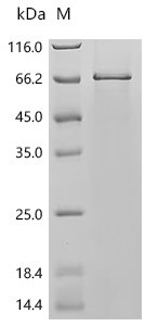 Human Myc proto-oncogene protein (MYC) Recombinant Protein, C-His, Homo sapiens (Human), E.coli, C-terminal 6xHis-tagged, 54.8 kDa, purity >≥ 85% as determined by SDS-PAGE.