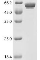 Flock house virus Protein B2 (B2), Biotinylated Recombinant Protein - BioCrest Sci