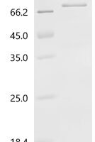 Human Polyunsaturated fatty acid 5-lipoxygenase (ALOX5) Recombinant Protein, C-10His - BioCrest Sci