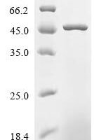 Staphylococcus aureus Iron-regulated surface determinant protein B (isdB), partial Recombinant Protein, C-His - BioCrest Sci
