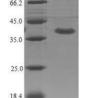 Mouse Interleukin-1 receptor-like 2 (Il1rl2), partial Recombinant Protein - BioCrest Sci