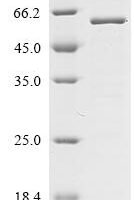 Mouse Ubiquitin carboxyl-terminal hydrolase 30 (Usp30), partial Recombinant Protein - BioCrest Sci