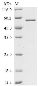 Mouse Ubiquitin carboxyl-terminal hydrolase 30 (Usp30), partial Recombinant Protein, Mus musculus (Mouse), E.coli, C-terminal 6xHis-tagged, 59.2 kDa, purity >≥ 85% as determined by SDS-PAGE.
