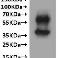Mouse B-lymphocyte antigen CD20 (Ms4a1)-VLPs Recombinant Protein - BioCrest Sci