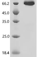 Mouse Delta-like protein 4 (Dll4), partial Recombinant Protein - BioCrest Sci