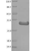 Mouse Histone deacetylase complex subunit SAP130 (Sap130), partial Recombinant Protein, N-His, aa 845–1057, E.coli - BioCrest Sci