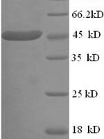 Human Creatine kinase U-type, mitochondrial (CKMT1A) Recombinant Protein, N-His - BioCrest Sci