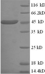 Human Creatine kinase U-type, mitochondrial (CKMT1A) Recombinant Protein, N-His, Homo sapiens (Human), E.coli, N-terminal 6xHis-tagged, 47.1 kDa, purity >≥ 90% as determined by SDS-PAGE.