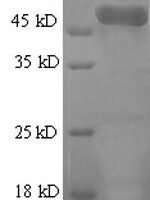 Human Actin-related protein 2/3 complex subunit 2 (ARPC2), partial Recombinant Protein, N-GST - BioCrest Sci