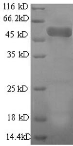 Human Actin-related protein 2/3 complex subunit 2 (ARPC2), partial Recombinant Protein, N-GST, Homo sapiens (Human), E.coli, N-terminal GST-tagged, 55.5 kDa, purity >≥ 90% as determined by SDS-PAGE.