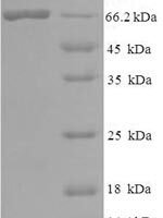 Human papillomavirus type 18 Minor capsid protein L2 (L2) Recombinant Protein, N-His-SUMO - BioCrest Sci