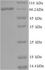 Human papillomavirus type 18 Minor capsid protein L2 (L2) Recombinant Protein, N-His-SUMO, Human papillomavirus type 18, E.coli, N-terminal 6xHis-SUMO-tagged, 65.6 kDa, purity >≥ 90% as determined by SDS-PAGE.